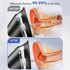 Electric USB Rechargeable Earwax Removal Cleaner Tool