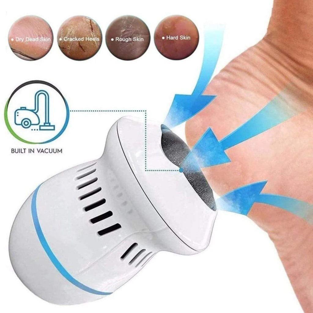 Electric Foot Grinder Callus Remover Pedicure Tool