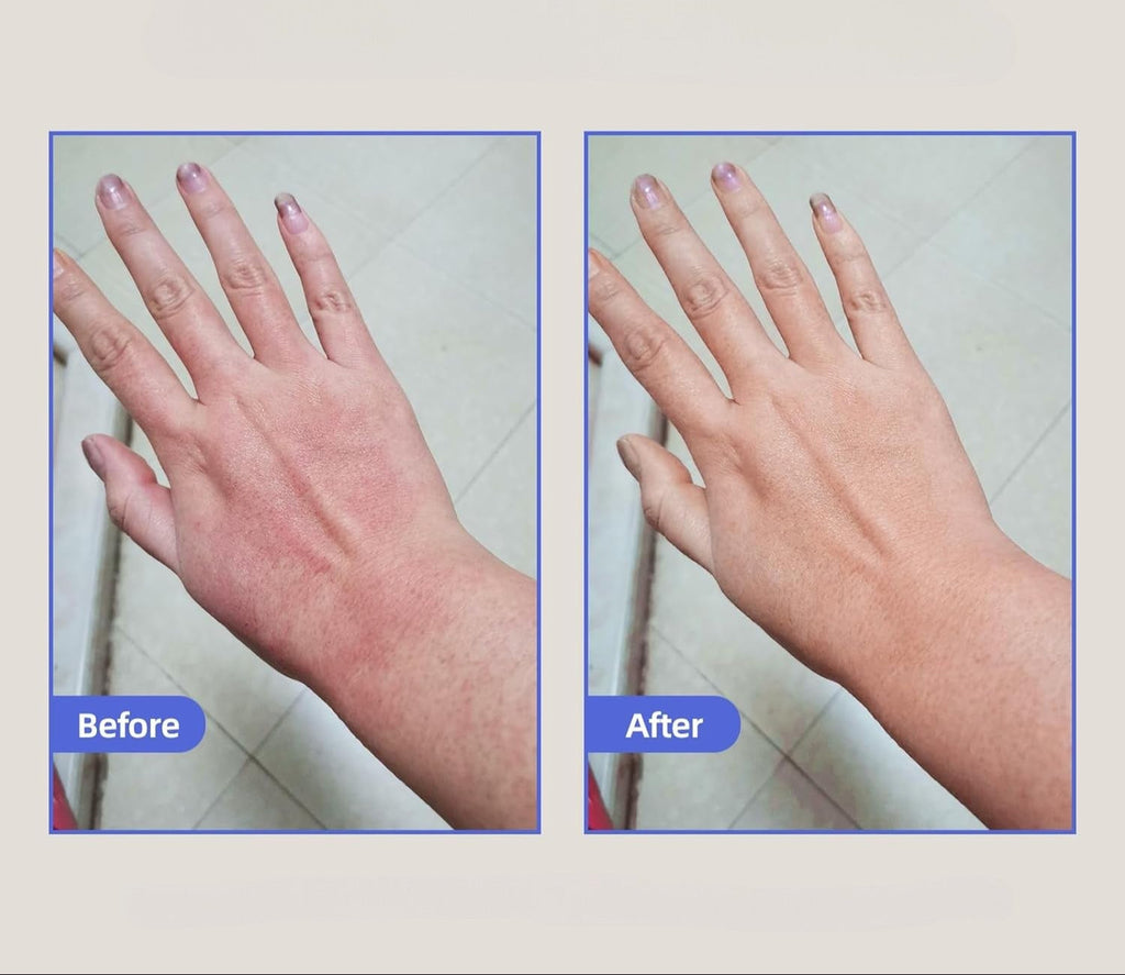 Eczema Relief Cream with Aloe Vera and Oats Skin Moisturizer Cream