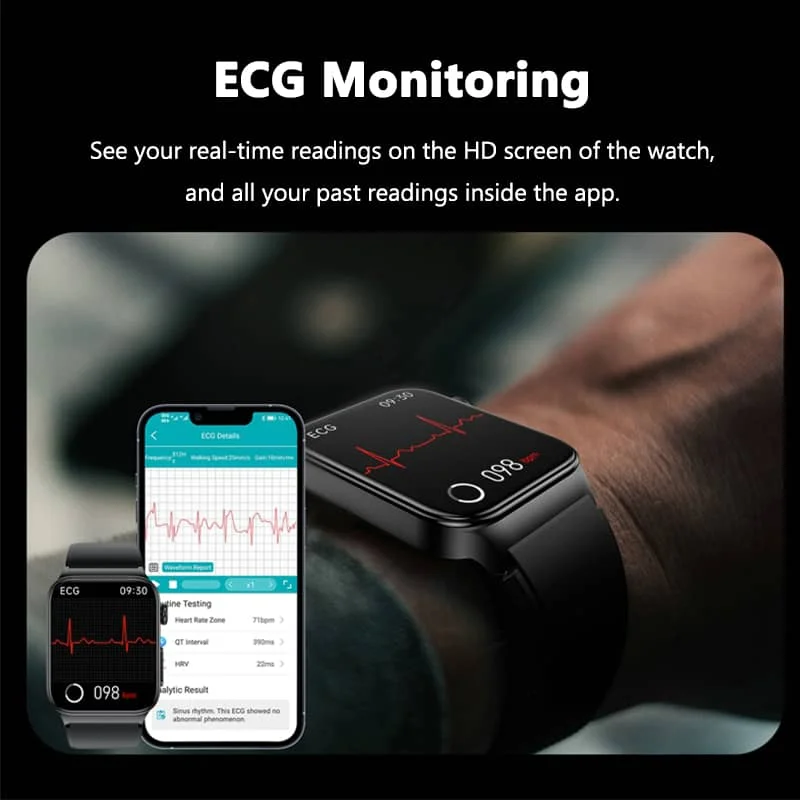 Smartwatch Circular Health Monitor with ECG and Blood Glucose Tracker